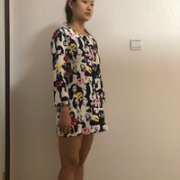中墺整形医院做吸脂减肥技术如何?前后对比图为你呈现! width=