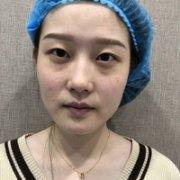赵小忠祛斑技术如何?我也想拥有美白肌肤! width=