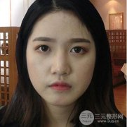 张建龙做鼻部整形技术如何?拥有好看鼻子就这么简单! width=