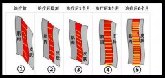 编主又又又偷偷做了热拉提plus和全脸射频啦~ width=