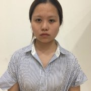 林伟亮医生做丰额头技术如何?我想天庭饱满! width=
