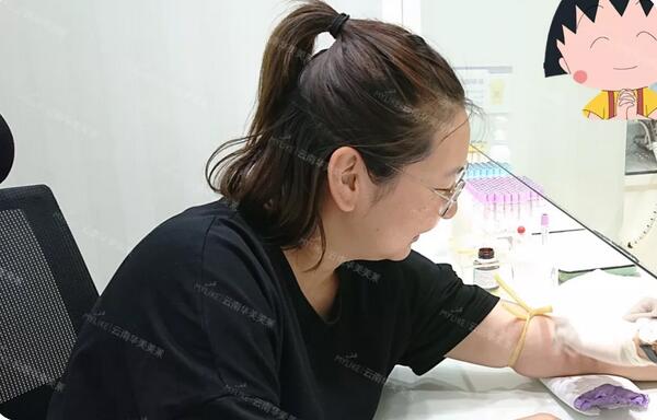云南华美美莱李韬急速纳米双眼皮案例昏享，超值滴~