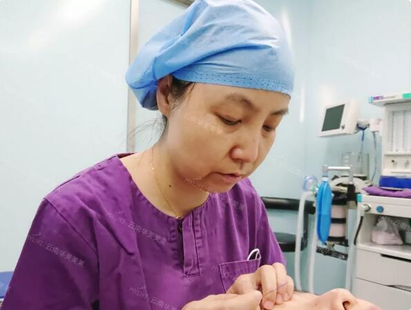 云南华美美莱李韬急速纳米双眼皮案例昏享，超值滴~