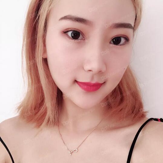 成都铜雀台割双眼皮怎么样？先来看看杨建医生的案例吧！