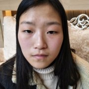 汕头伊丽莎白整形医院眼部手术技术怎么样?我这眼睛还能改变吗? width=