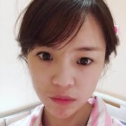 济南美莱整形医院双眼皮技术如何?能想要的果不? width=