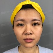陈柏森医生除皱抗衰技术怎么样?我想恢复年轻貌美! width=