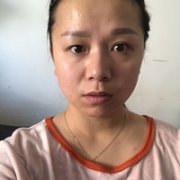 西之米整形医院做双眼皮果如何?能那种自然微创的状态吗? width=