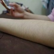 石家庄美联臣脱毛技术怎么样?我再也不想毛毛躁躁的了! width=