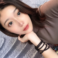 鼻唇沟微整形果怎么样?真实案例分享~