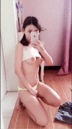 宁波薇琳医美怎么样?隆胸真实案例分享~