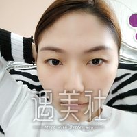 赵士俊割双眼皮怎么样?能让我与众不同吗?