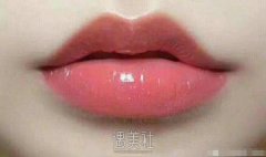 嘴角上扬术怎么做的，手术过程复杂不? width=