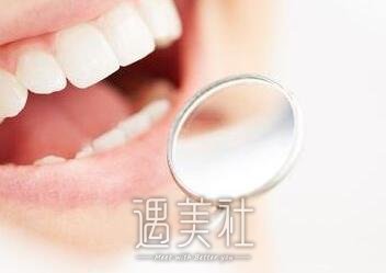 自锁托槽牙齿矫正的果如何?都有哪些优点?