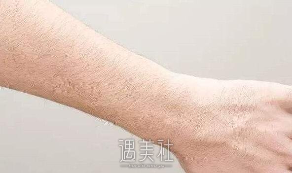 绝缘微针脱毛多少钱?哪些因素影响价格呢?