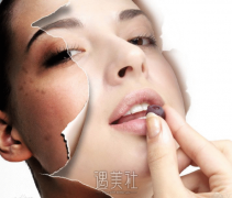 像素激光祛斑价格大概多少?在什么区间比较合理? width=