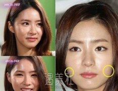 申世京整容前后判若两人?申世京整容前后揭秘~ width=