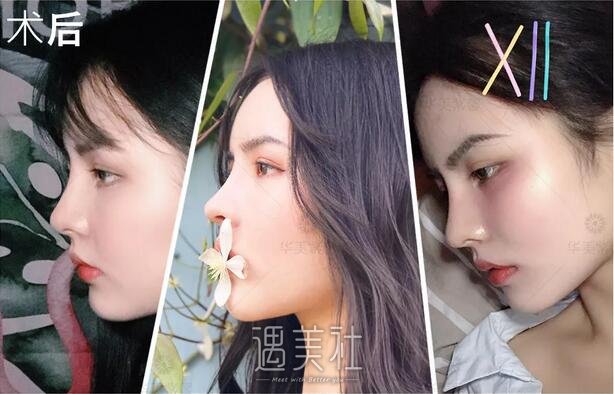 很女声历届冠-军扎堆换买家秀的塑料头，鼻子还能跟着承受几次？ width=