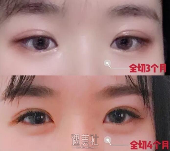 张冰洁整形医生怎么样?有张冰洁整形案例看看吗?