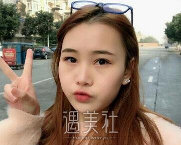 福州,武警整形,注射瘦脸