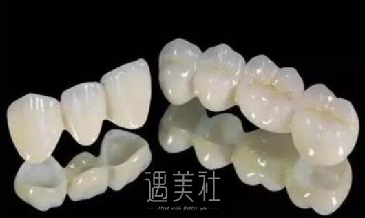 亳州做全瓷牙贴面大概多少钱?费用一般在哪个区间?