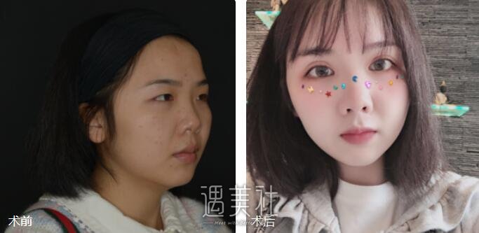 解永学