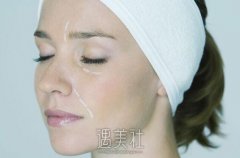 面部光纤溶脂有副作用吗|光纤溶脂副作用多方位起底～ width=