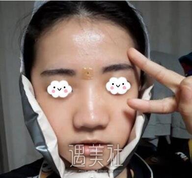 章建林,正颌