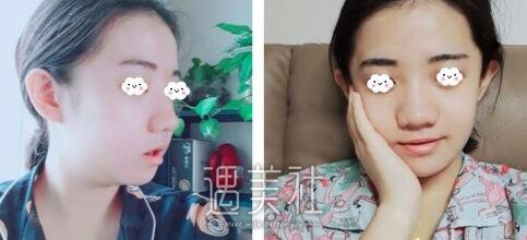 章建林,正颌