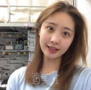 吴包金医生切痣案例：脸上的痣没有了，就像明星一样 width=