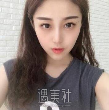 刘滢,光子嫩肤