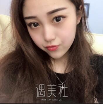 刘滢,光子嫩肤