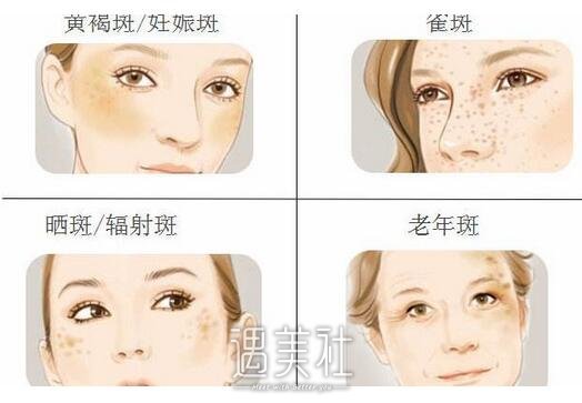 赵小忠