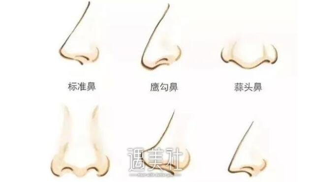 广州蒜头鼻矫正多少钱?是不是价格越高果越好?