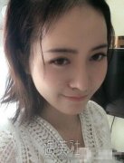 玻尿酸丰唇的果怎么样|玻尿酸丰唇的真实案例硬核分享~ width=