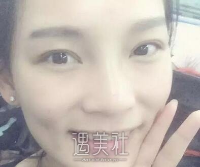 张姣姣,双眼皮
