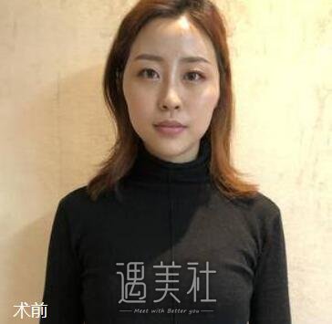 上海,金海兰,丰额头