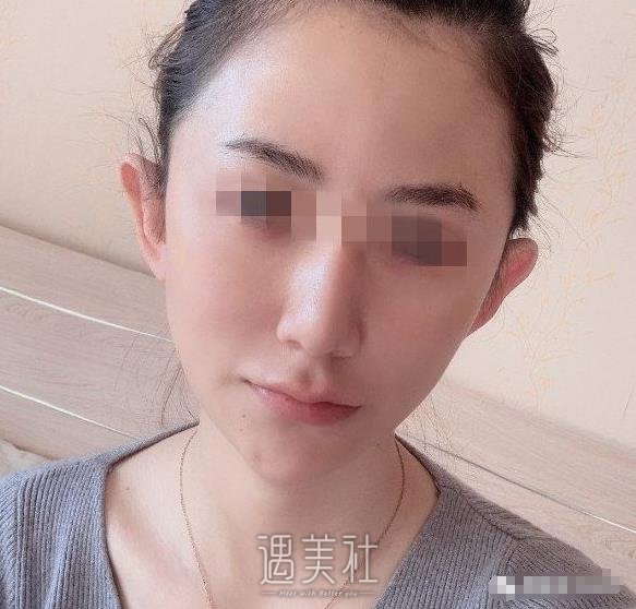 首尔丽格崔荣达面部不对称矫正案例：变美原来这么简单~
