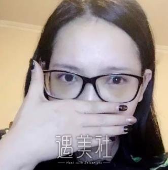 北京,卓彦,祛眼袋