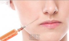 三亚自体脂肪鼻唇沟填充术大约要多少钱?收费标准怎样的? width=