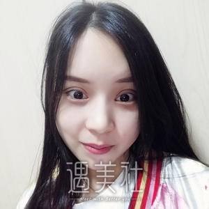 开外眼角前后对比