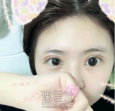 张晓棠,双眼皮