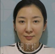 彩光嫩肤有用吗?前阵子做了彩光嫩肤的我想高调回答下～ width=
