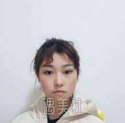 广美整形做了注射瘦脸，没想到打一针的果堪比磨骨喃～ width=