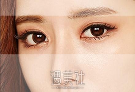 亚韩割双眼皮多少钱，为什么各地的价格都不固定喃?