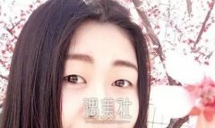 宋宝强做双眼皮自然嘛，有没有宋宝强近期案例分享? width=
