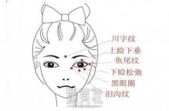 丽水全脸去皱价格一般多少钱?大概有这几个影响因素~ width=