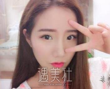 徐永安,面部填充
