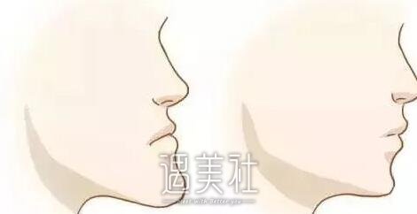 青岛,调节地包天