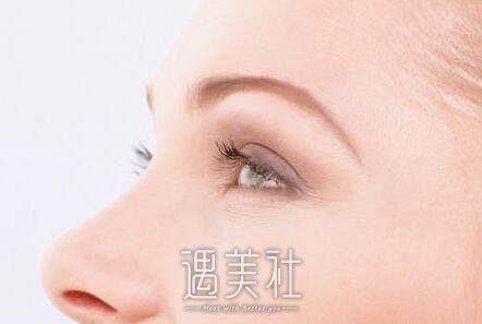 常州,激光去鱼尾纹